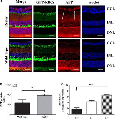 Morphological and biomolecular targets in retina and vitreous from Reelin-deficient mice (Reeler): Potential implications for age-related macular degeneration in Alzheimer’s dementia